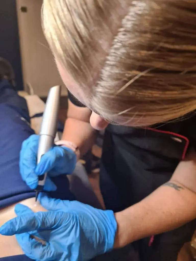 Jen performing a CryoPen treatment